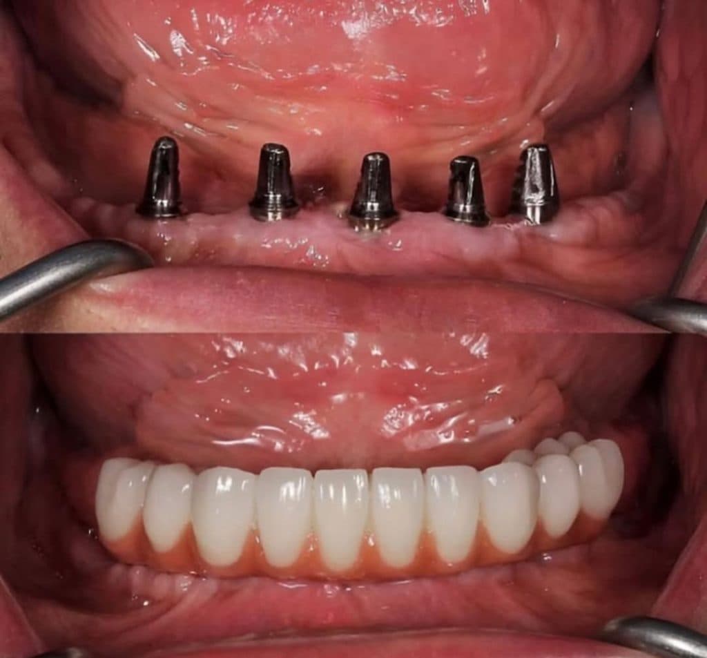 مرکز تخصصی جراحی ایمپلنت دکتر حامد محمودی در اندرزگو تهران