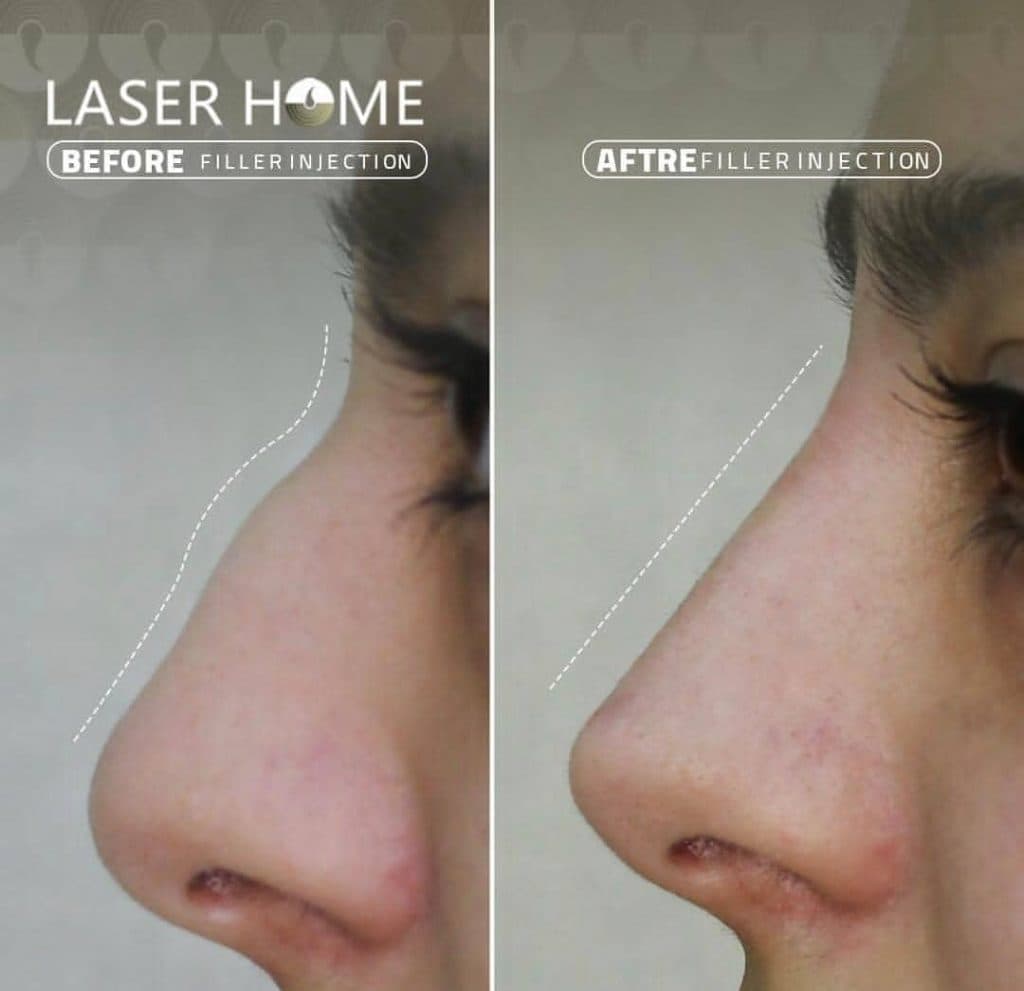 مرکز تخصصی زیبایی لیزر رویا در آبرسان تبریز