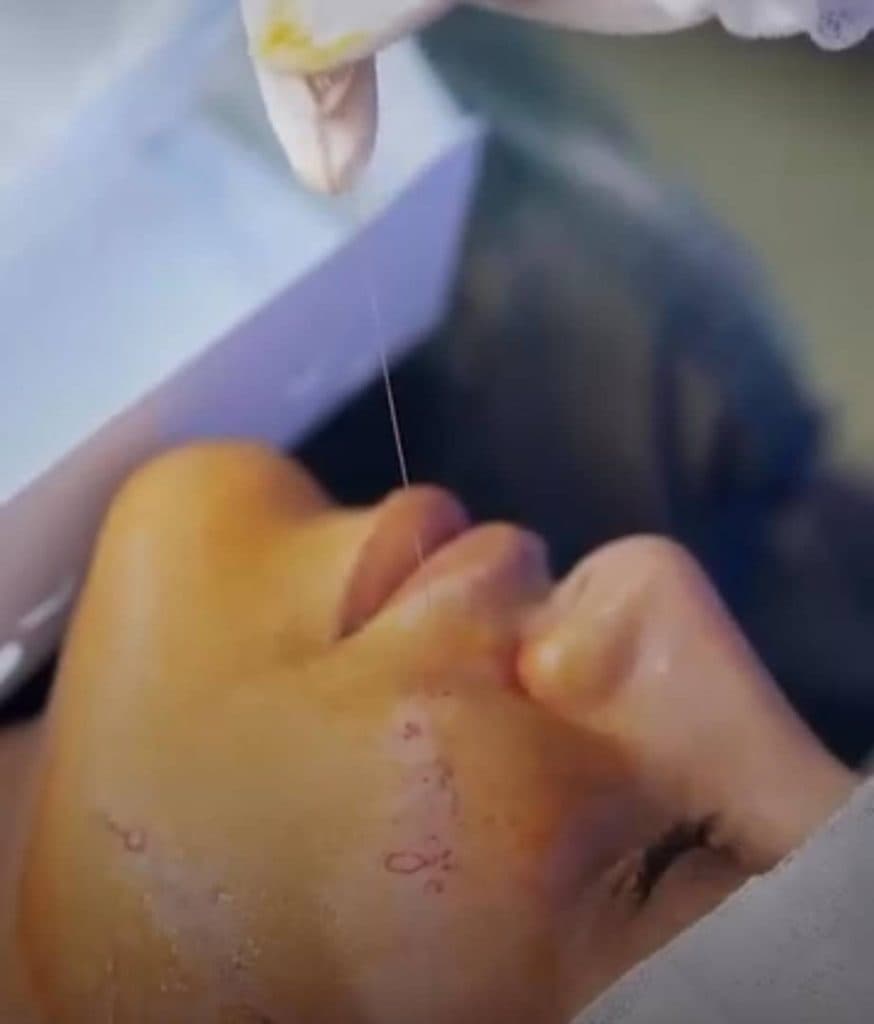 مرکز تخصصی زیبایی لیزر رویا در آبرسان تبریز