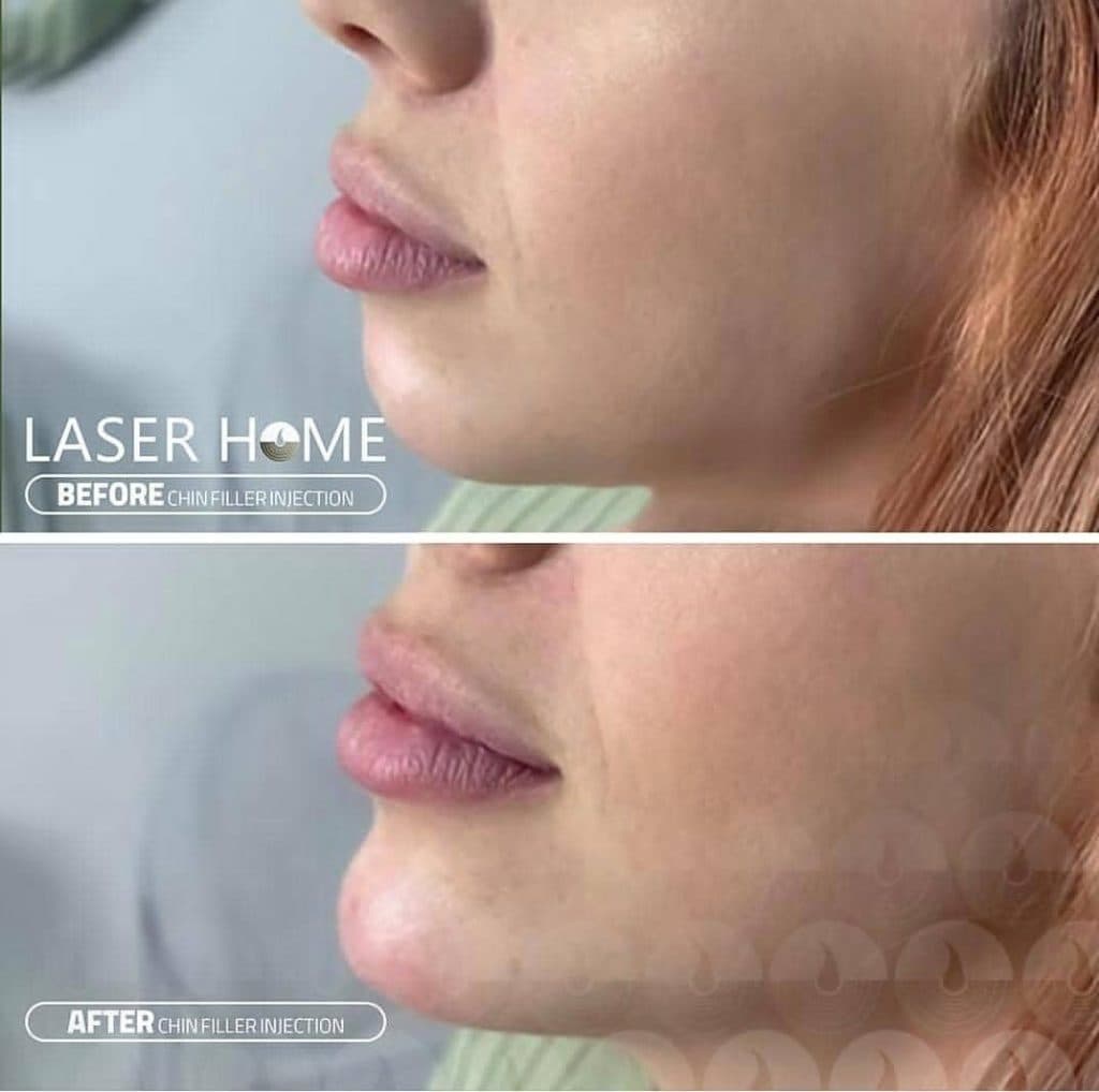 مرکز تخصصی زیبایی لیزر رویا در آبرسان تبریز