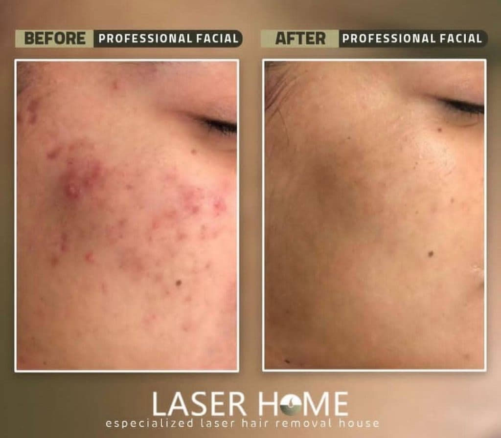 مرکز تخصصی زیبایی لیزر رویا در آبرسان تبریز