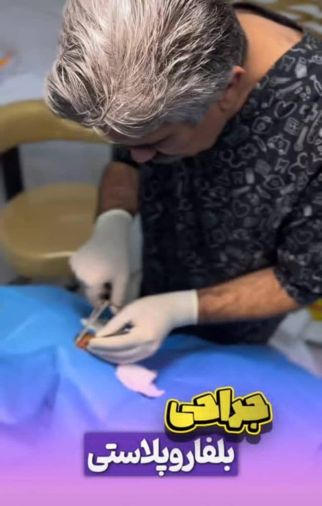 جراحی بلفاروپلاستی پلک بالا و پایین دکتر مصطفی دوستانی تبریز