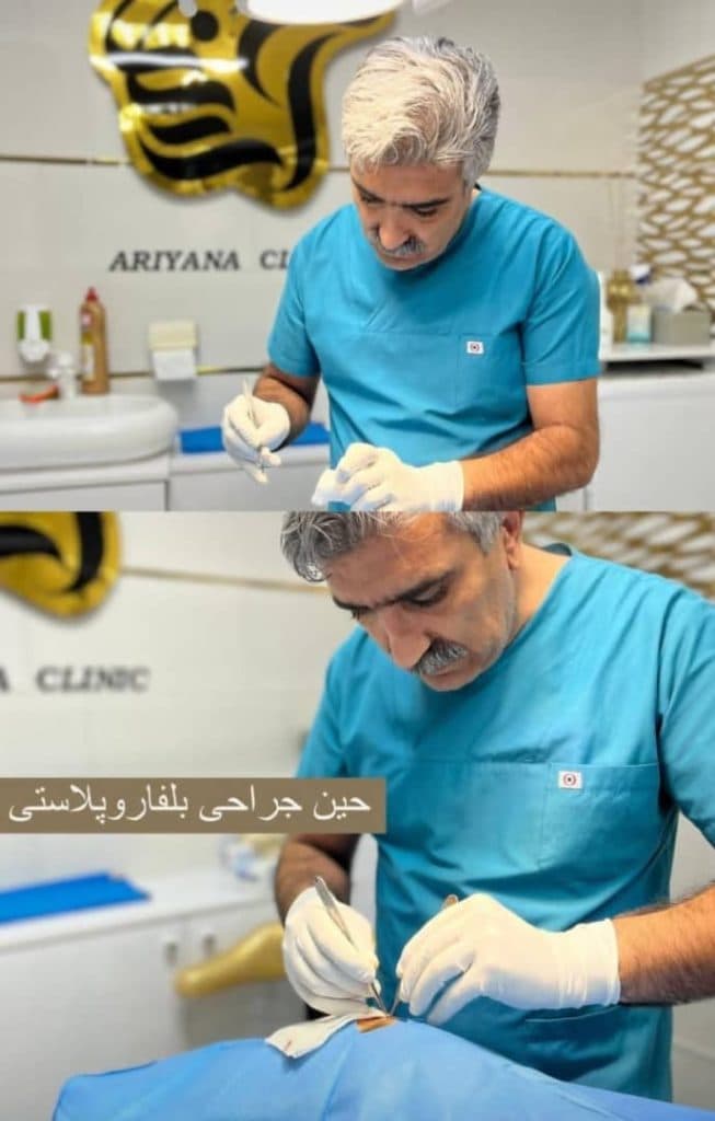 جراحی بلفاروپلاستی پلک بالا و پایین دکتر مصطفی دوستانی تبریز