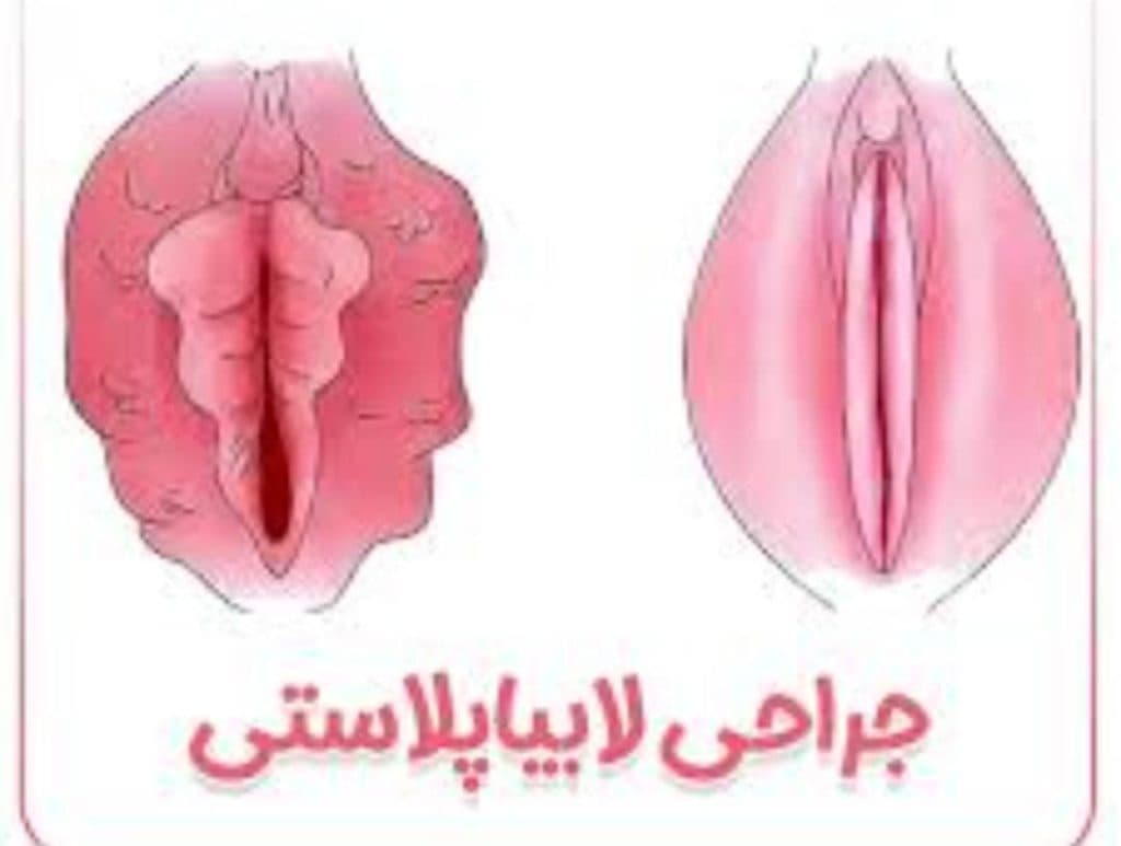 مرکز ترمیم بکارت جوانه در خرم آباد