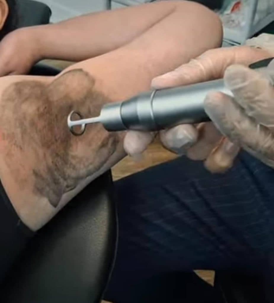 مرکز تخصصی لیزر موهای زائد نایس قاعدی رفسنجان