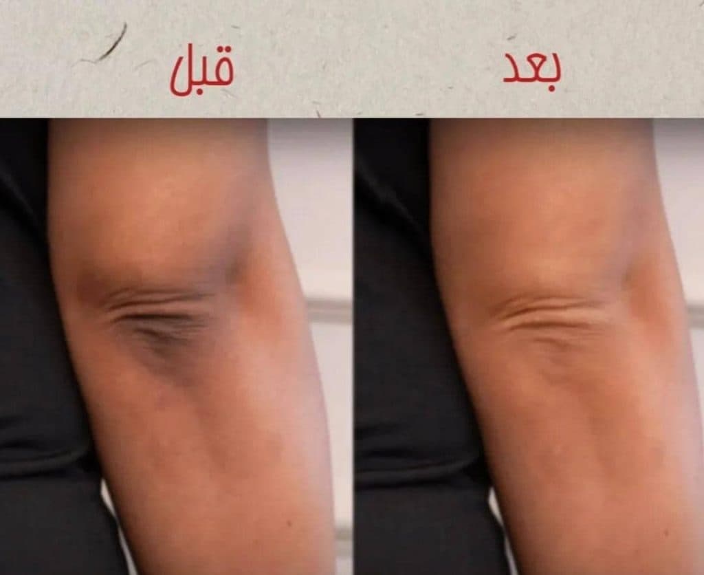 مرکز تخصصی لیزر موهای زائد نایس قاعدی رفسنجان