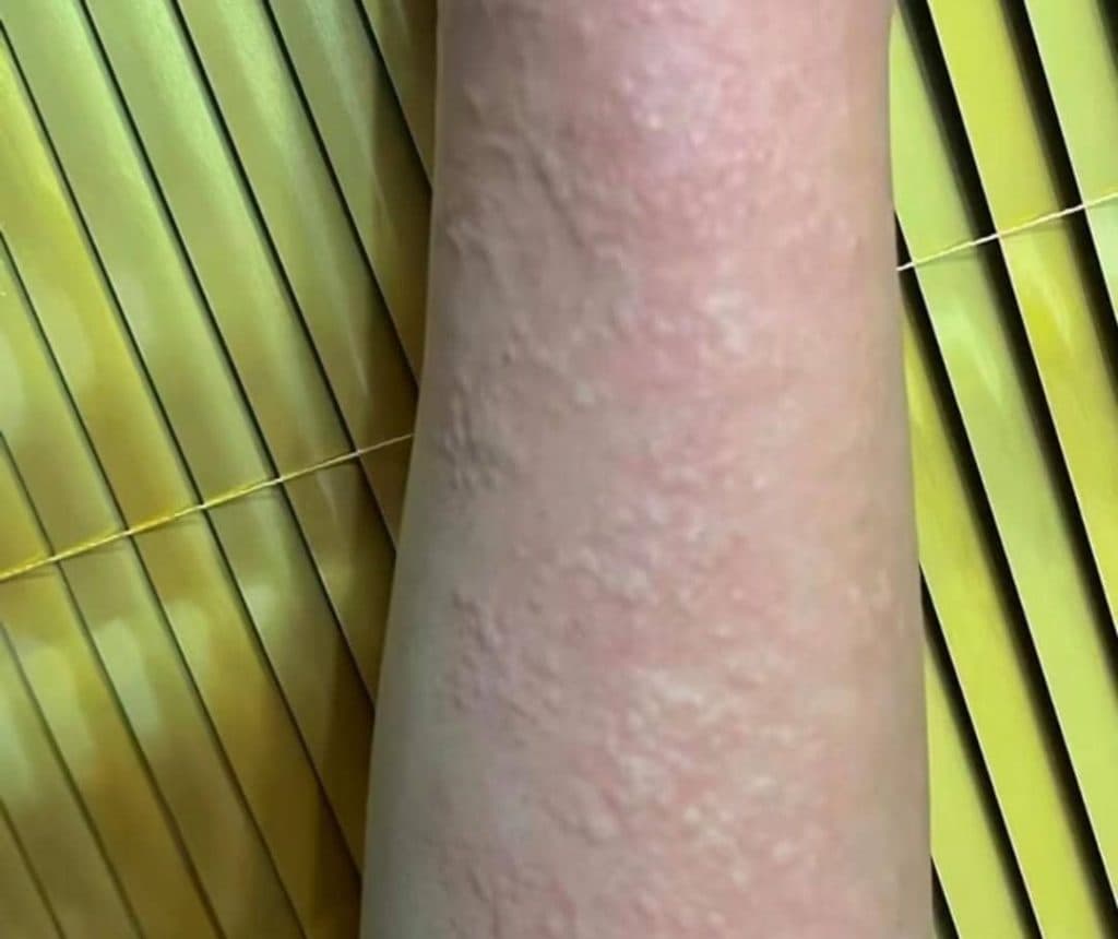 مرکز تخصصی لیزر موهای زائد نایس قاعدی رفسنجان