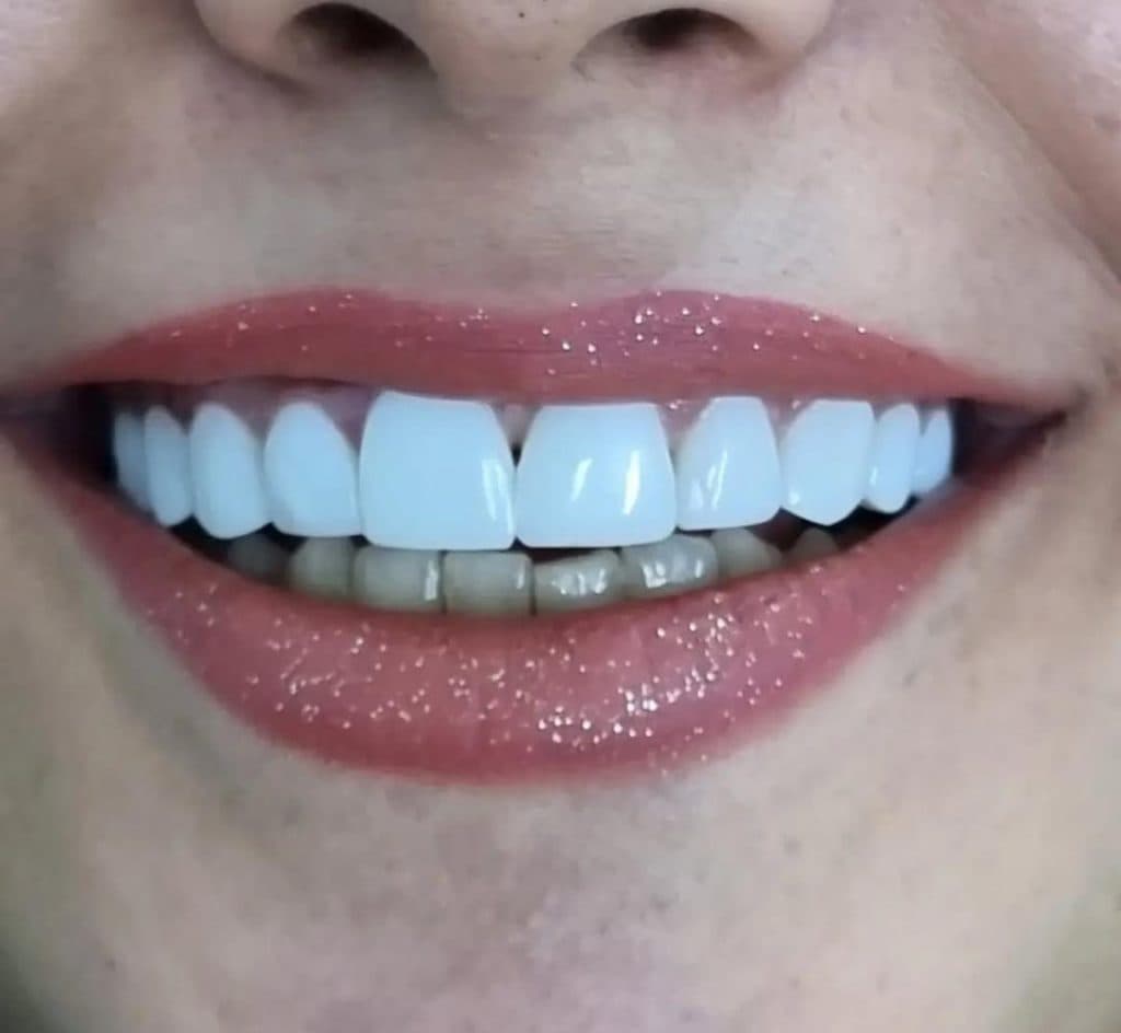 مطب دندانپزشکی استوما در تهران