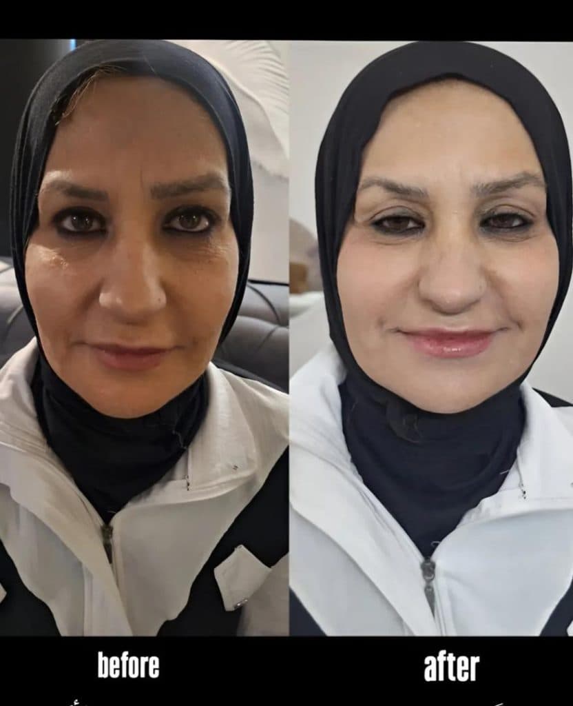 کلینیک زیبایی و درمانی اروین در احمدآباد مشهد