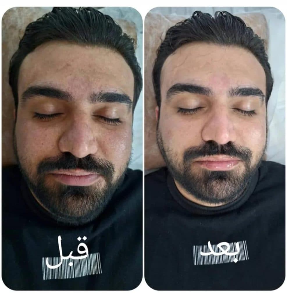 کلینیک زیبایی و درمانی اروین در احمدآباد مشهد