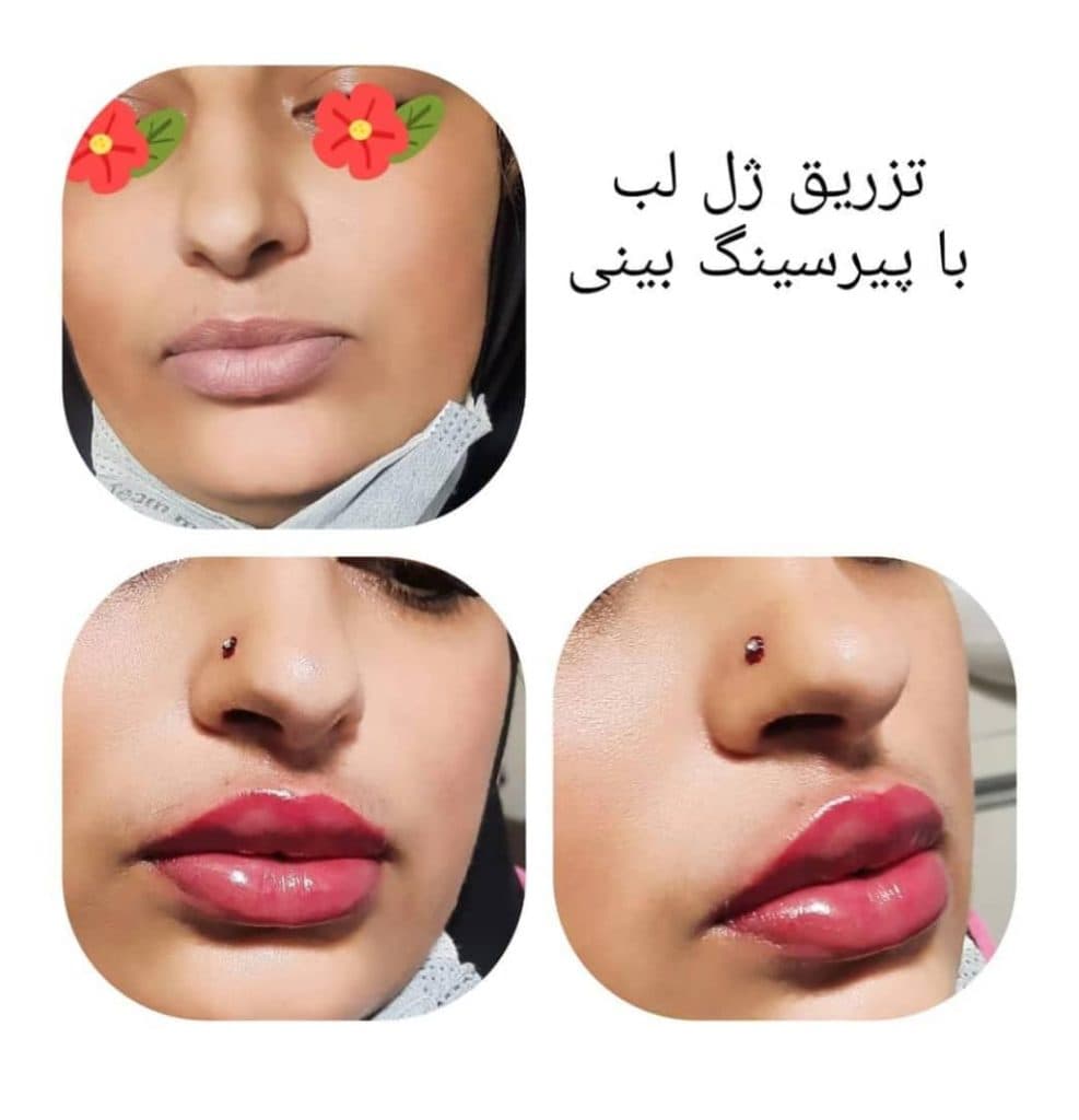 درمانگاه پزشکی الزهرا در حیدرآباد کرج
