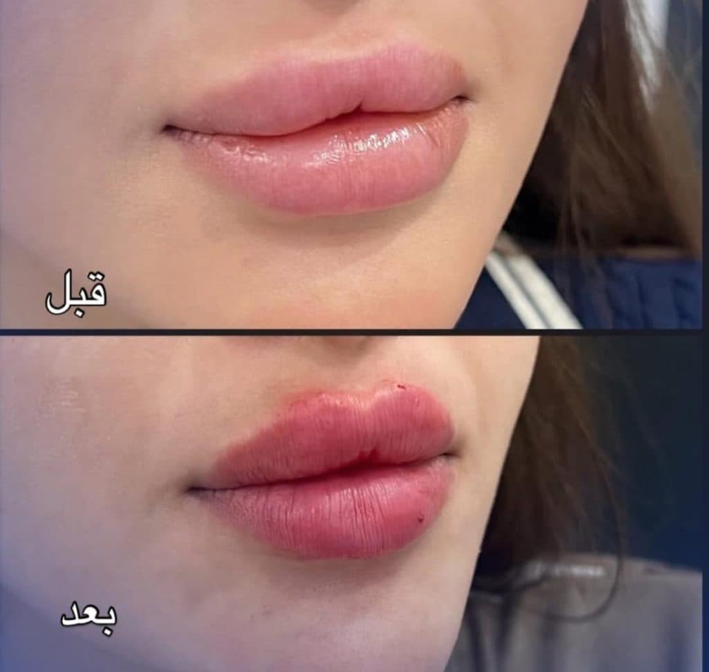 کلینیک زیبایی belleza در چهارراه شهرداری قزوین