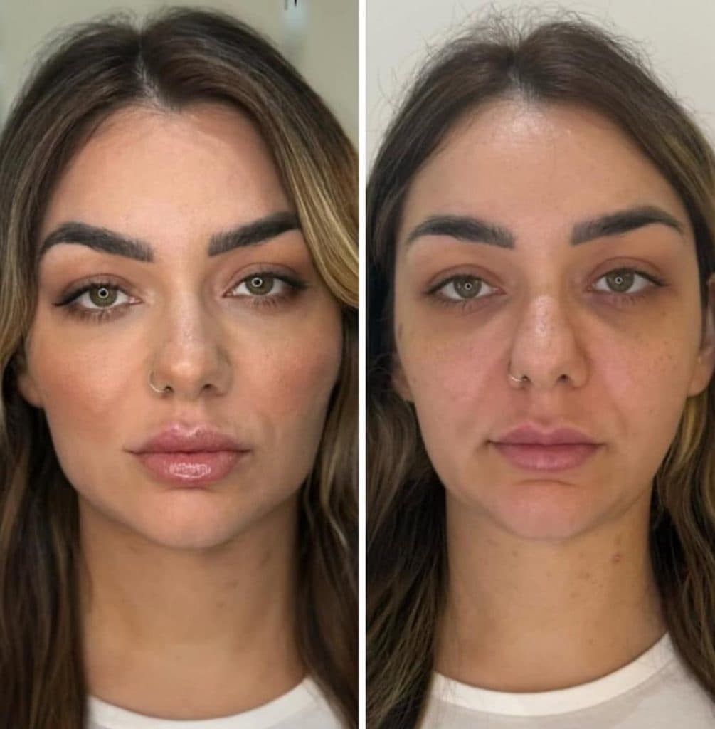 کلینیک زیبایی belleza در چهارراه شهرداری قزوین