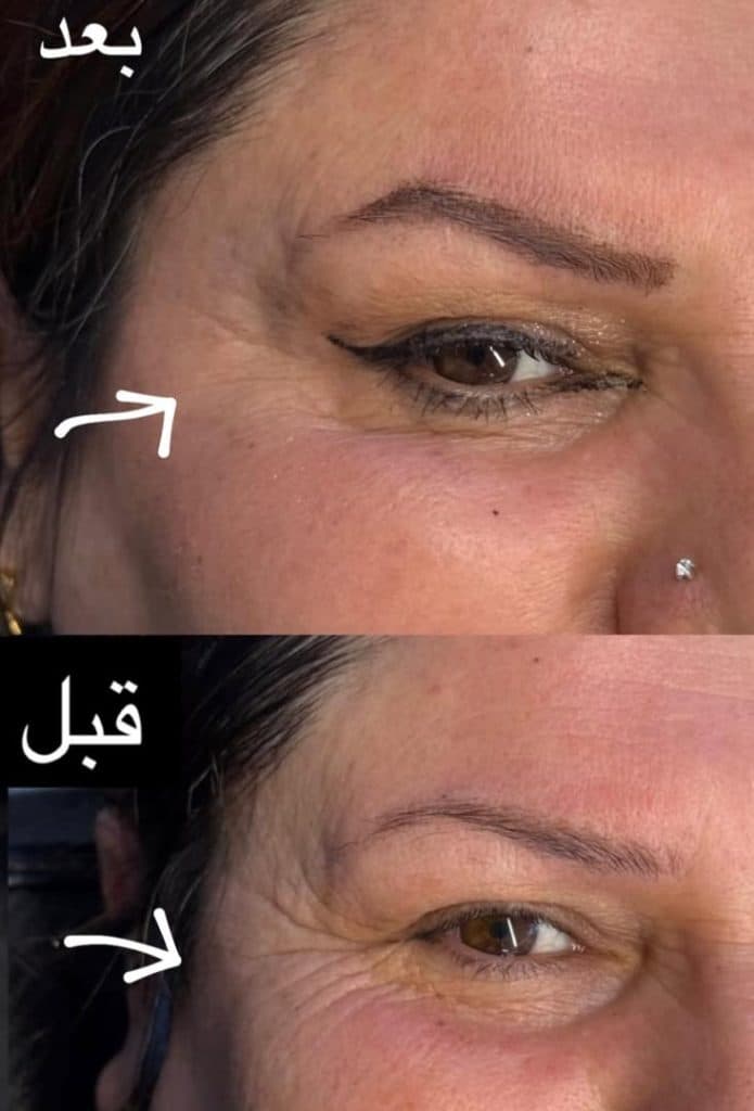 کلینیک زیبایی belleza در چهارراه شهرداری قزوین