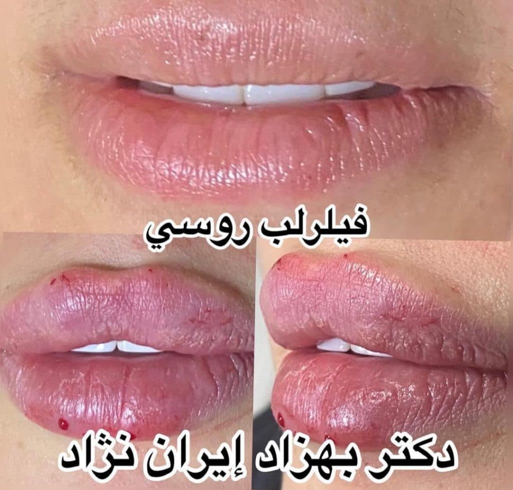 مطب زیبایی پوست و مو دکتر بهزاد ایران نژاد در پاسداران تهران