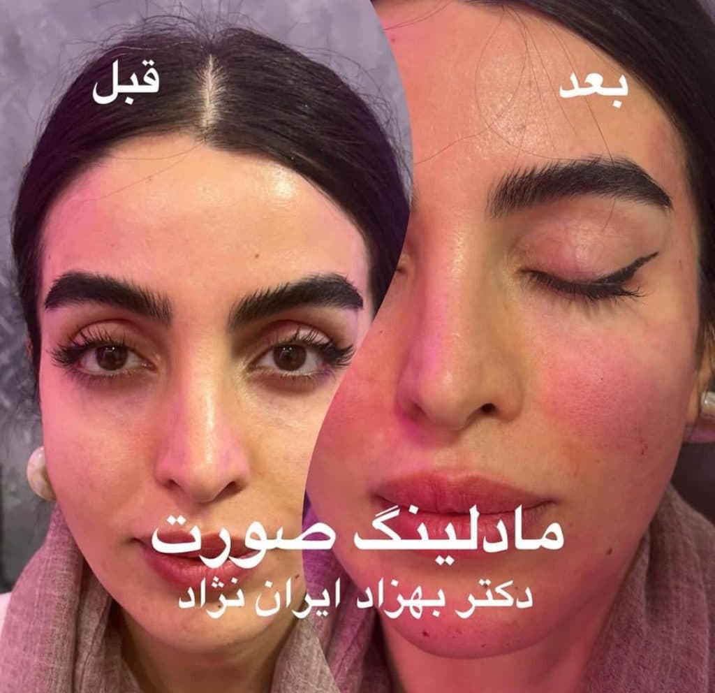 مطب زیبایی پوست و مو دکتر بهزاد ایران نژاد در پاسداران تهران