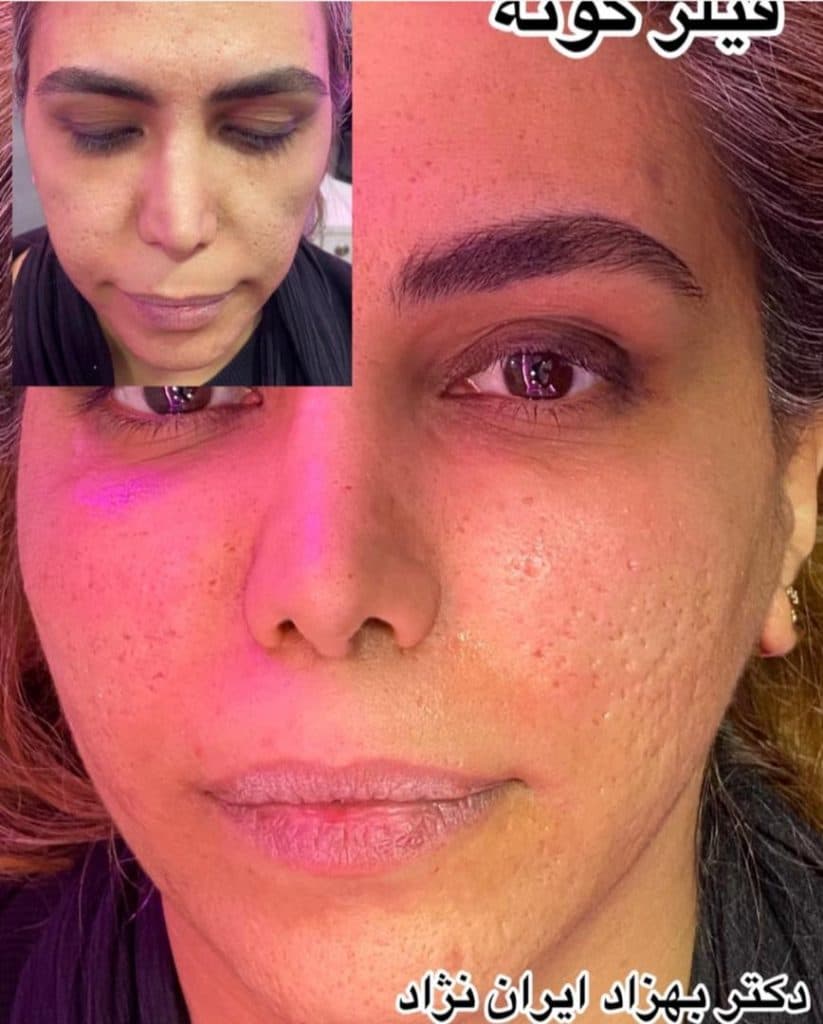 مطب زیبایی پوست و مو دکتر بهزاد ایران نژاد در پاسداران تهران