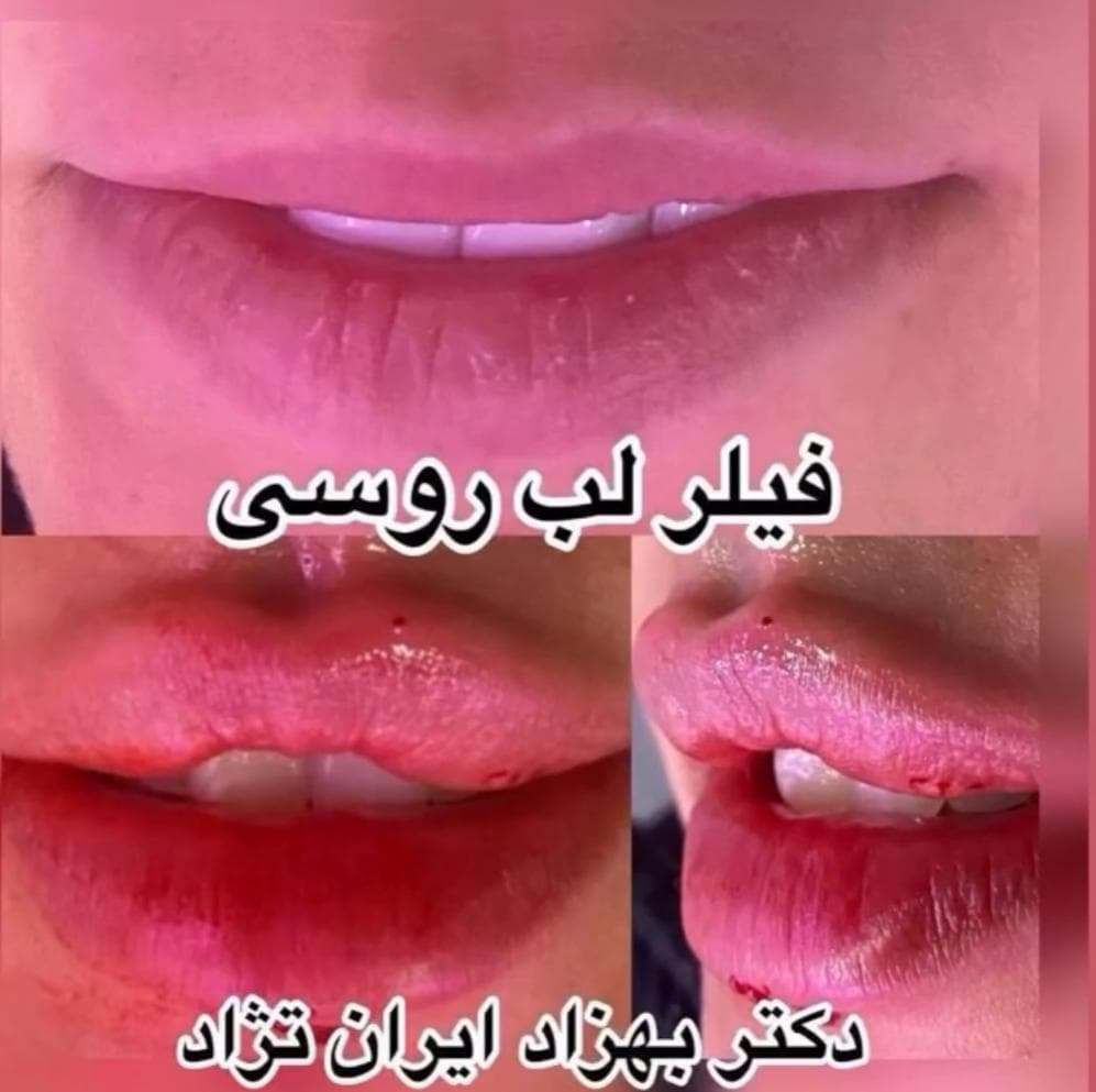 مطب زیبایی پوست و مو دکتر بهزاد ایران نژاد در پاسداران تهران