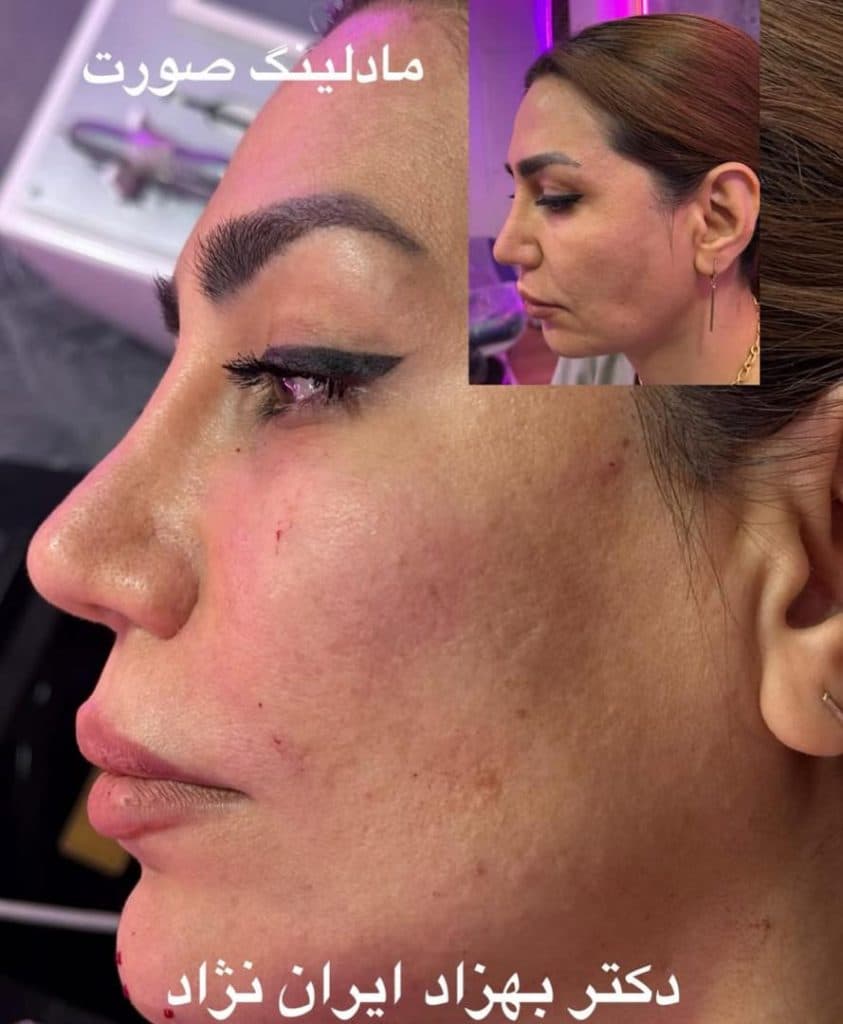 مطب زیبایی پوست و مو دکتر بهزاد ایران نژاد در پاسداران تهران