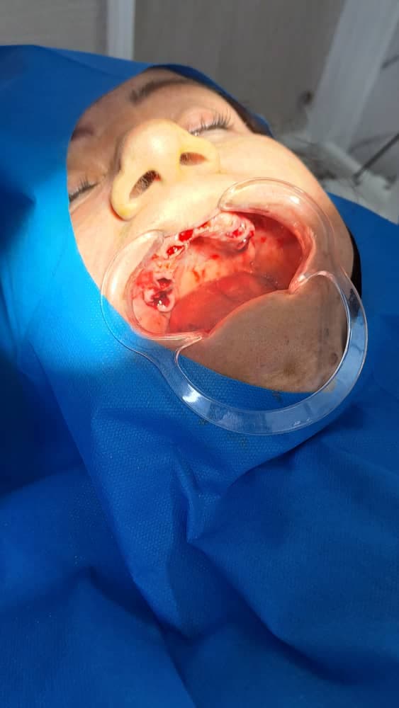 مرکز تخصصی ایمپلنت دندان دکتر مصطفی آلام تهرانپارس تهران