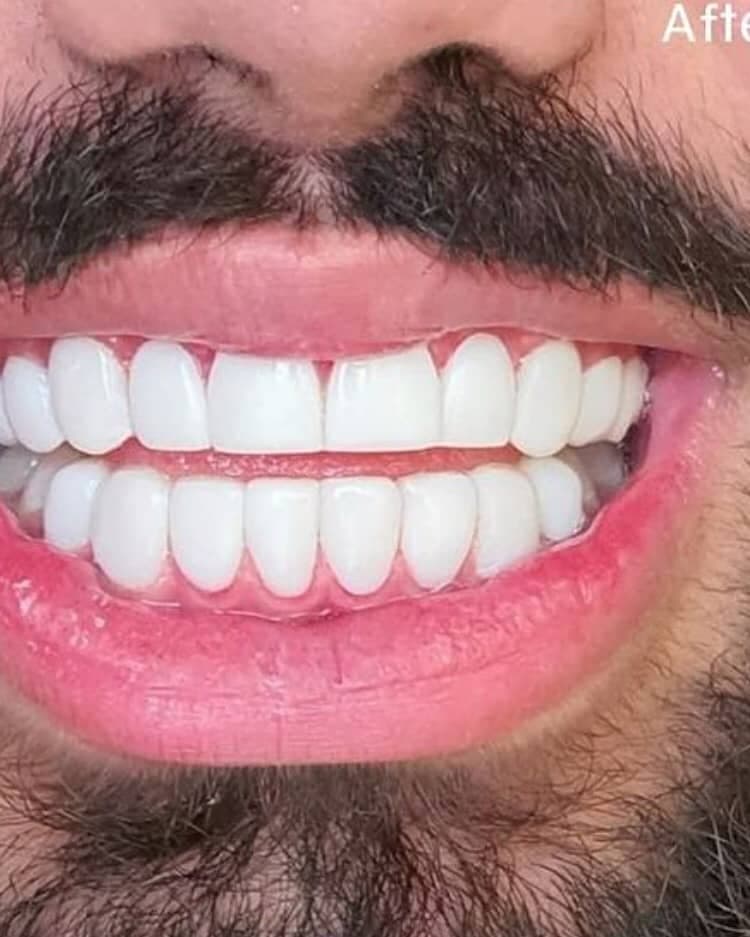 مرکز تخصصی ایمپلنت دندان دکتر مصطفی آلام تهرانپارس تهران