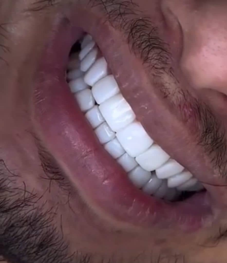 مرکز تخصصی ایمپلنت دندان دکتر مصطفی آلام تهرانپارس تهران