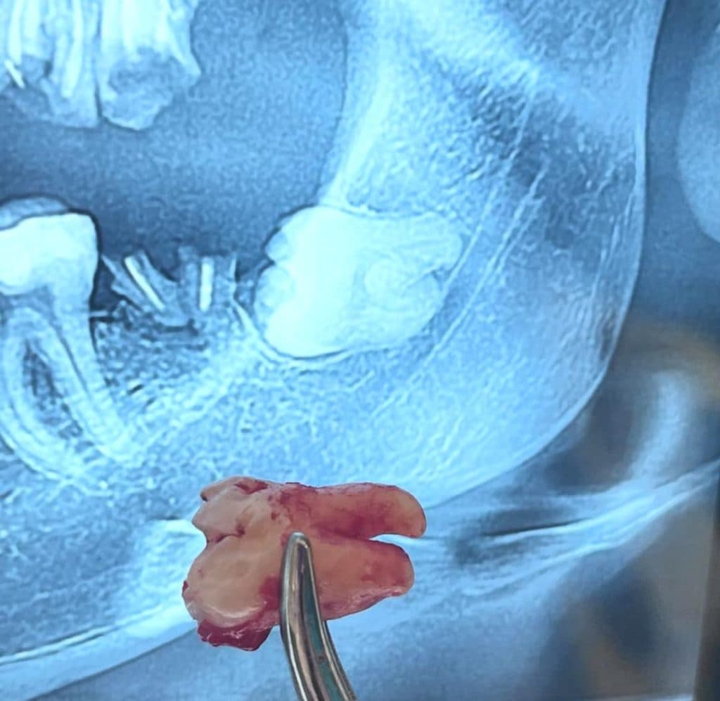 مطب دندانپزشکی دکتر شیما اصغری در مرزداران تهران