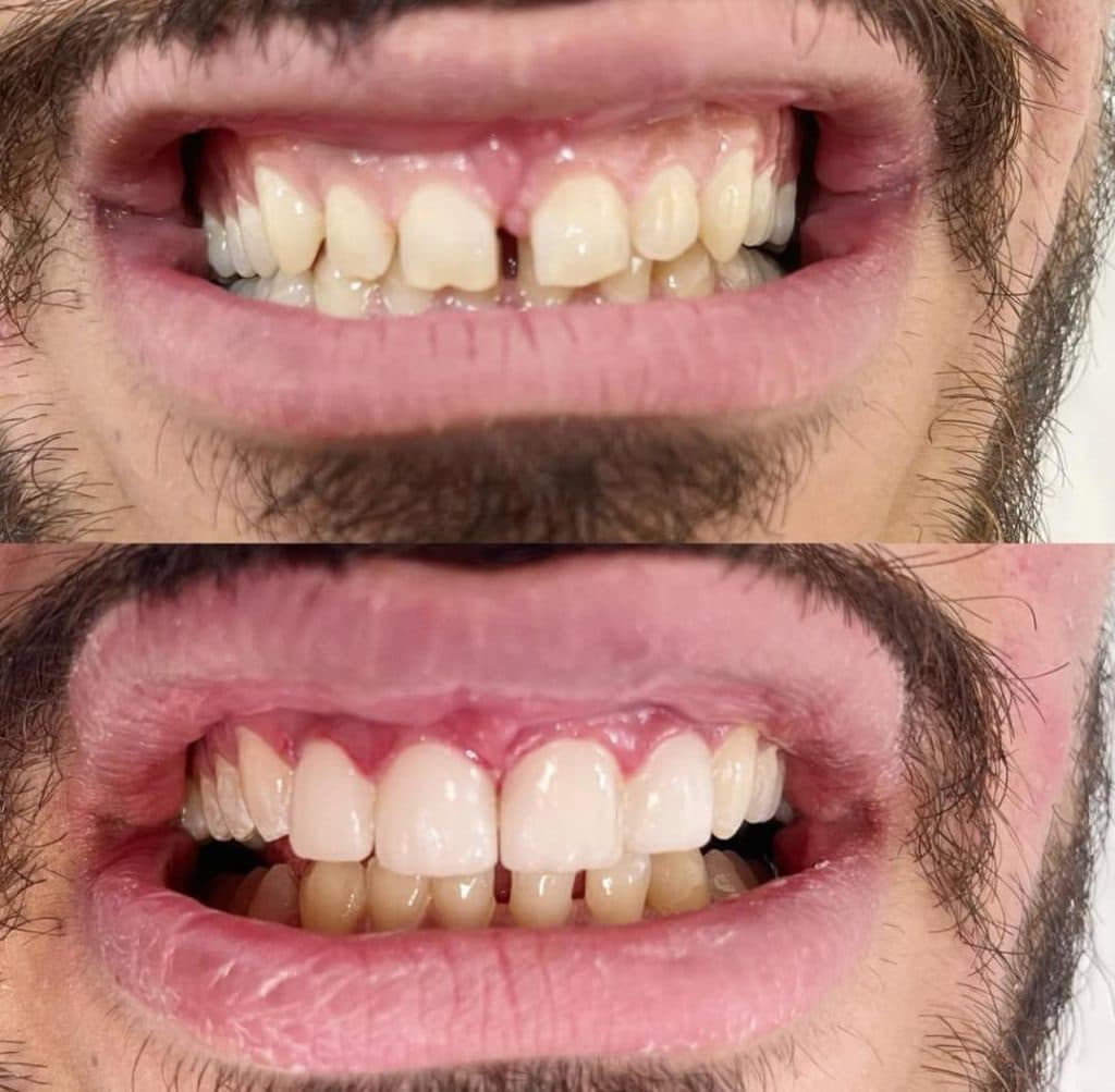 مطب دندانپزشکی دکتر شیما اصغری در مرزداران تهران