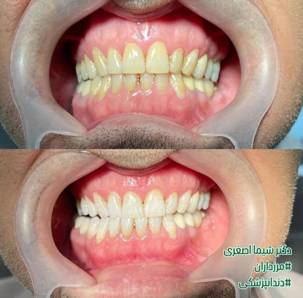 مطب دندانپزشکی دکتر شیما اصغری در مرزداران تهران