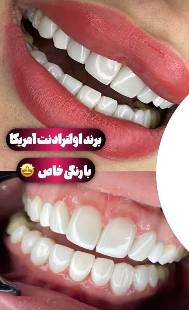 دندانپزشکی و خدمات کامپوزیت شبانه روزی صدف تهرانپارس تهران