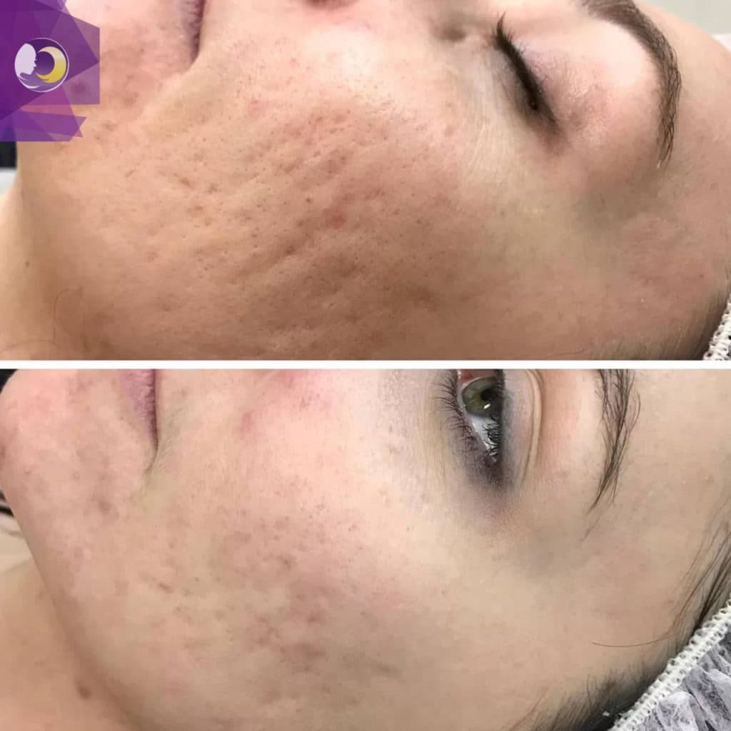 کلینیک مزوتراپی صدف در کرج