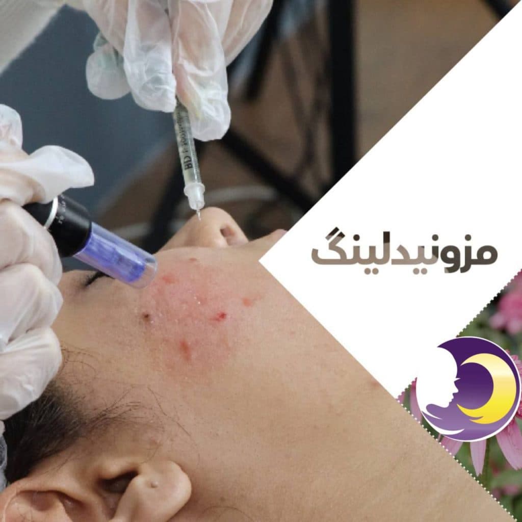 کلینیک مزوتراپی صدف در کرج