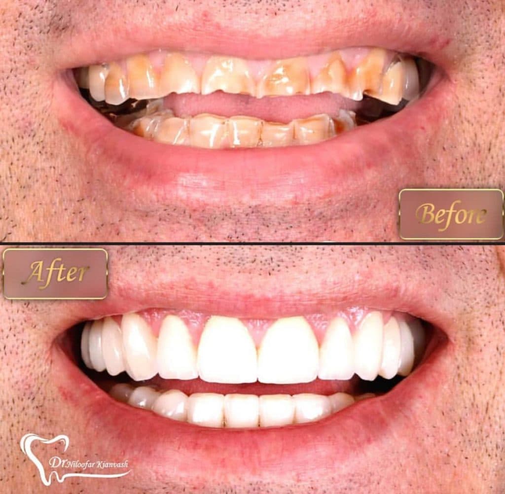 مرکز ایمپلنت سرو در سعادت آباد تهران