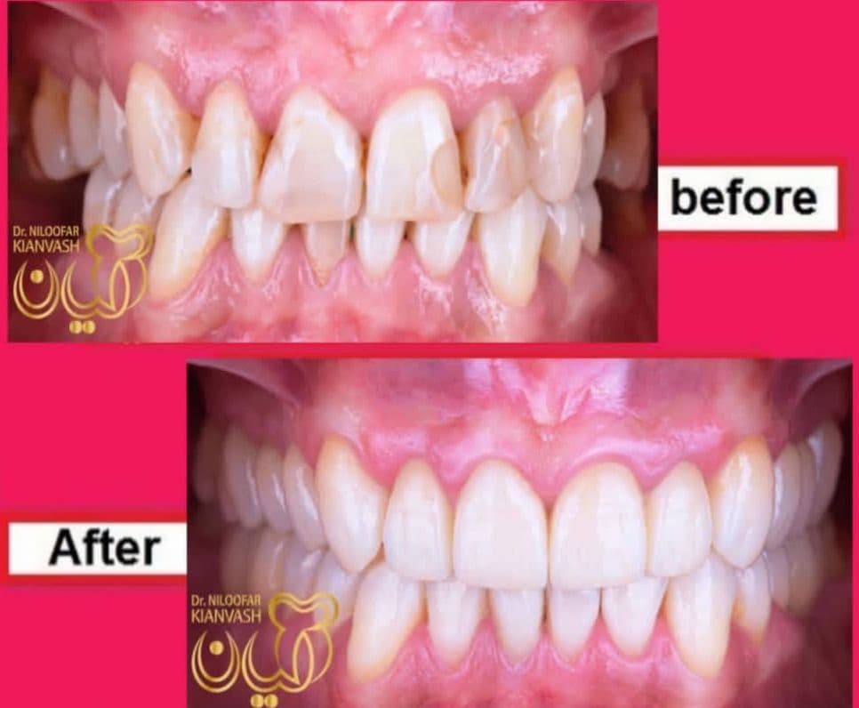 مرکز ایمپلنت سرو در سعادت آباد تهران