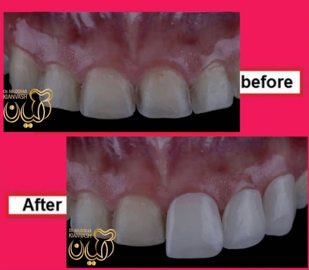 مرکز ایمپلنت سرو در سعادت آباد تهران