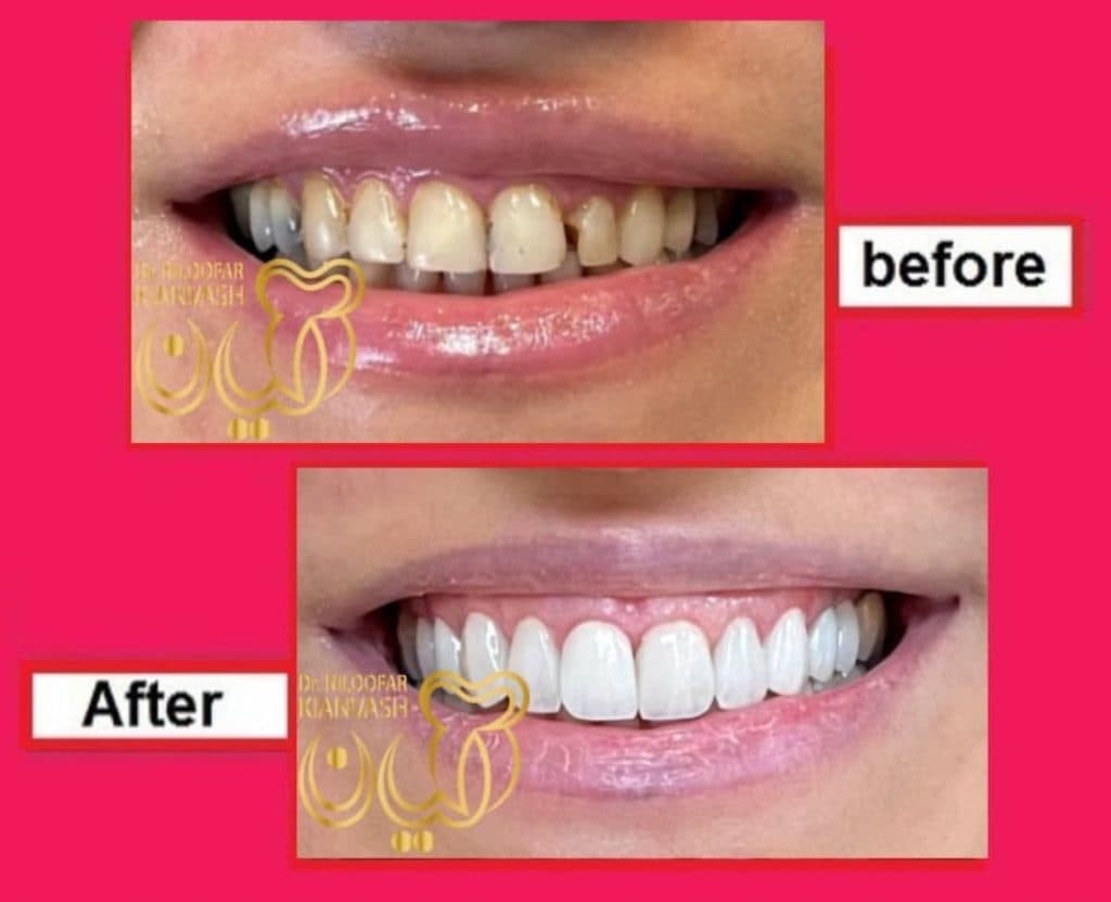 مرکز ایمپلنت سرو در سعادت آباد تهران