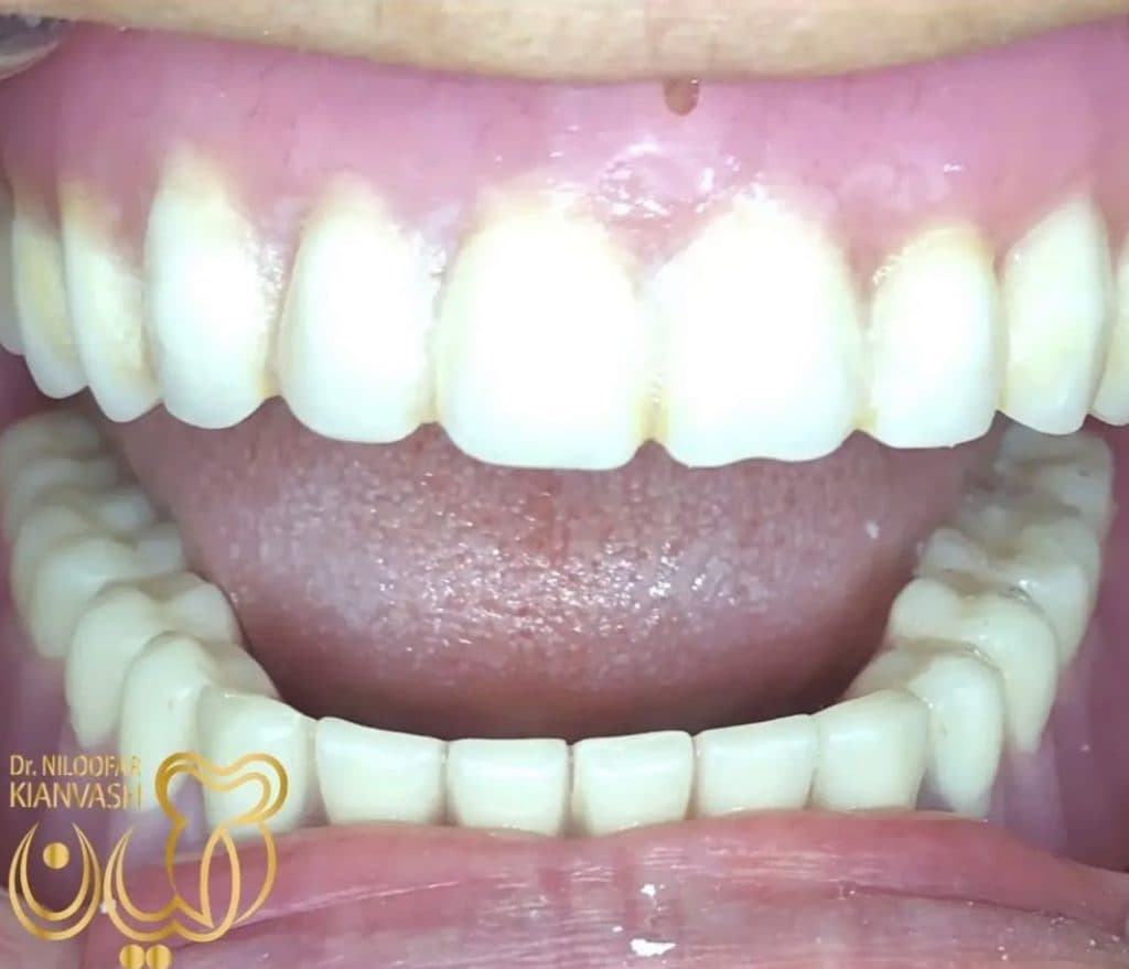 مرکز ایمپلنت سرو در سعادت آباد تهران