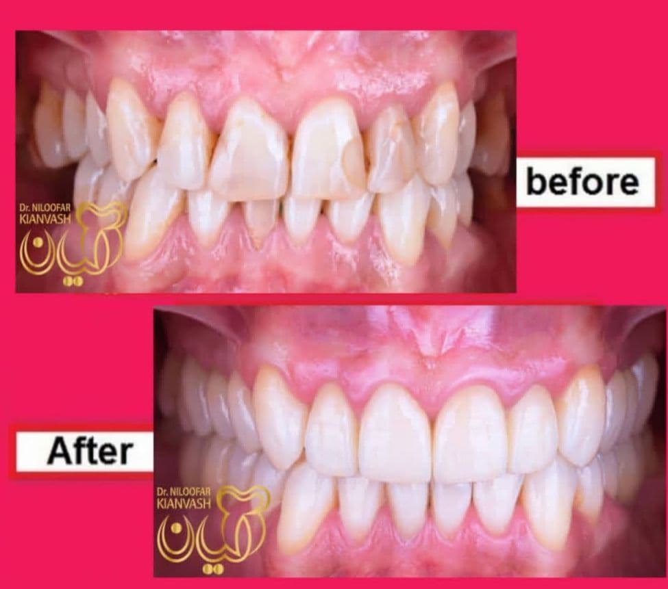 مرکز ایمپلنت سرو در سعادت آباد تهران