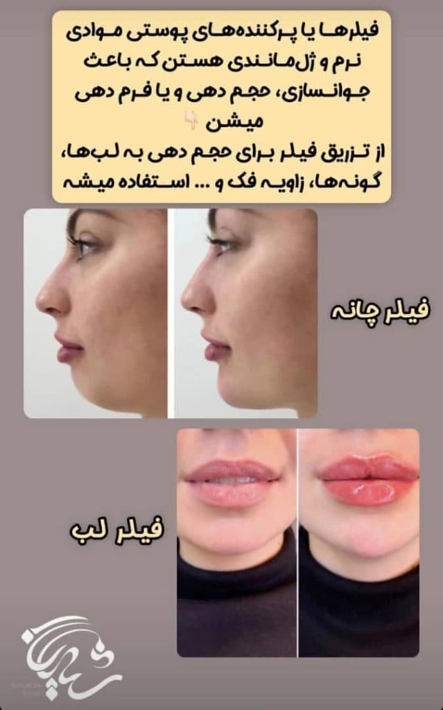 کلینیک پوست و مو شیدرخ در حمزه کرمان