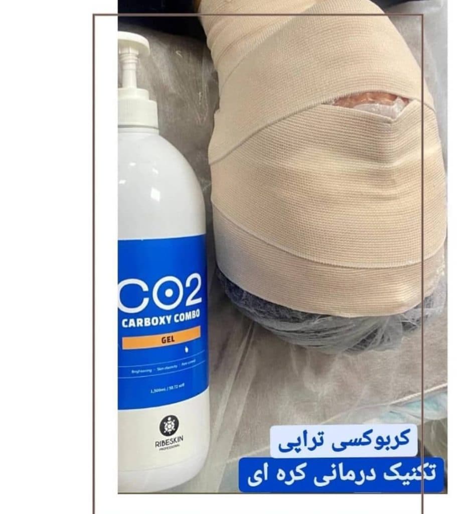 کلینیک پوست و مو شیدرخ در حمزه کرمان