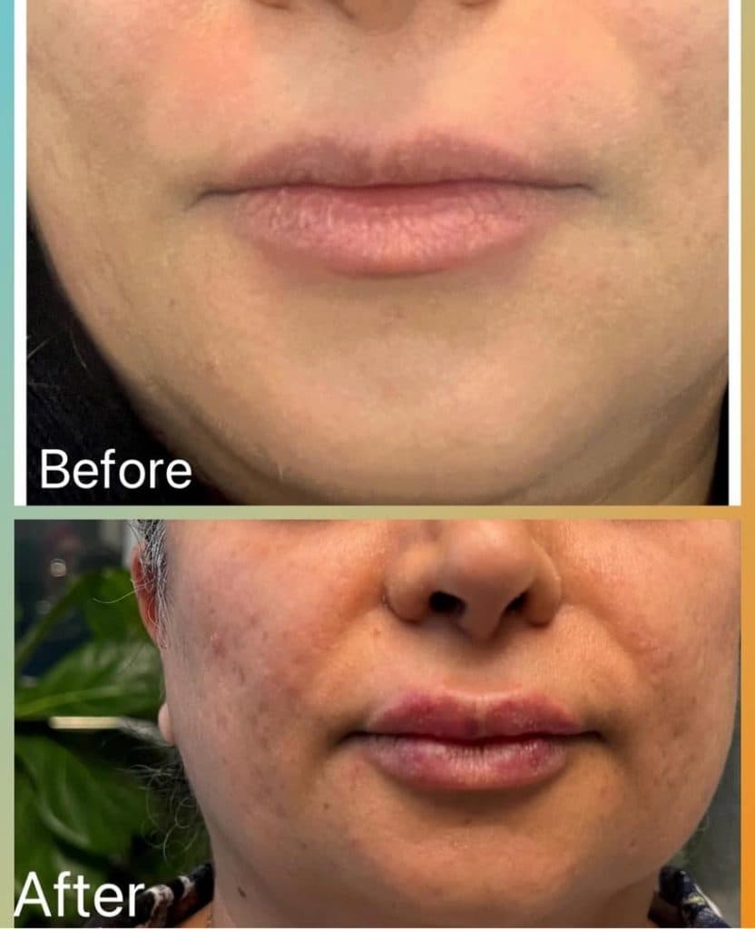 مطب زیبایی دکتر زهرا شخص امام پور در ملک آباد مشهد