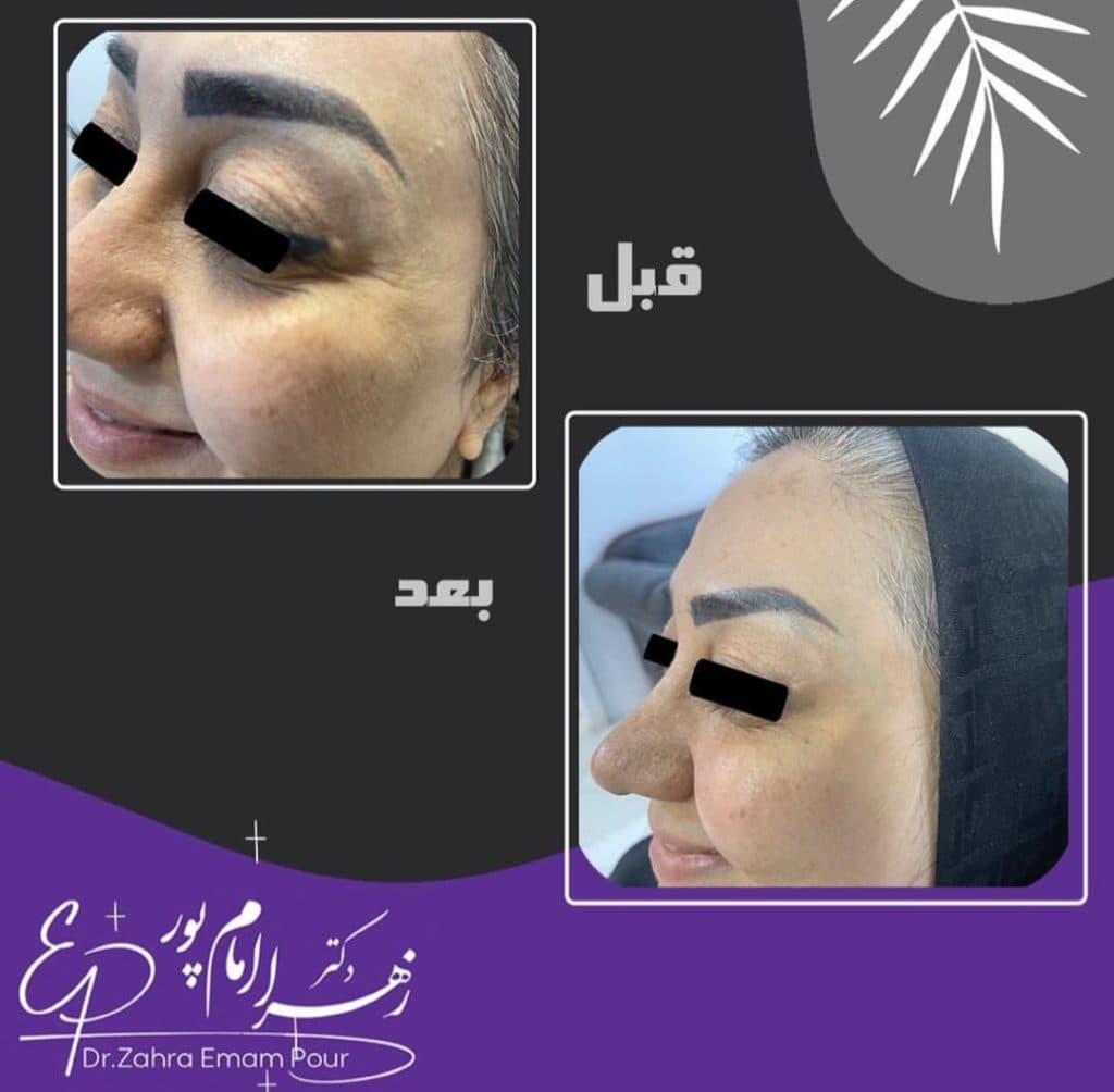 مطب زیبایی دکتر زهرا شخص امام پور در ملک آباد مشهد