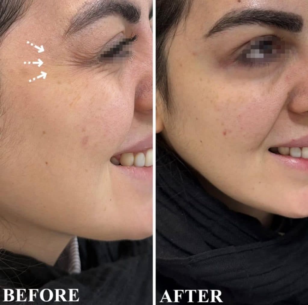 مطب زیبایی دکتر زهرا شخص امام پور در ملک آباد مشهد