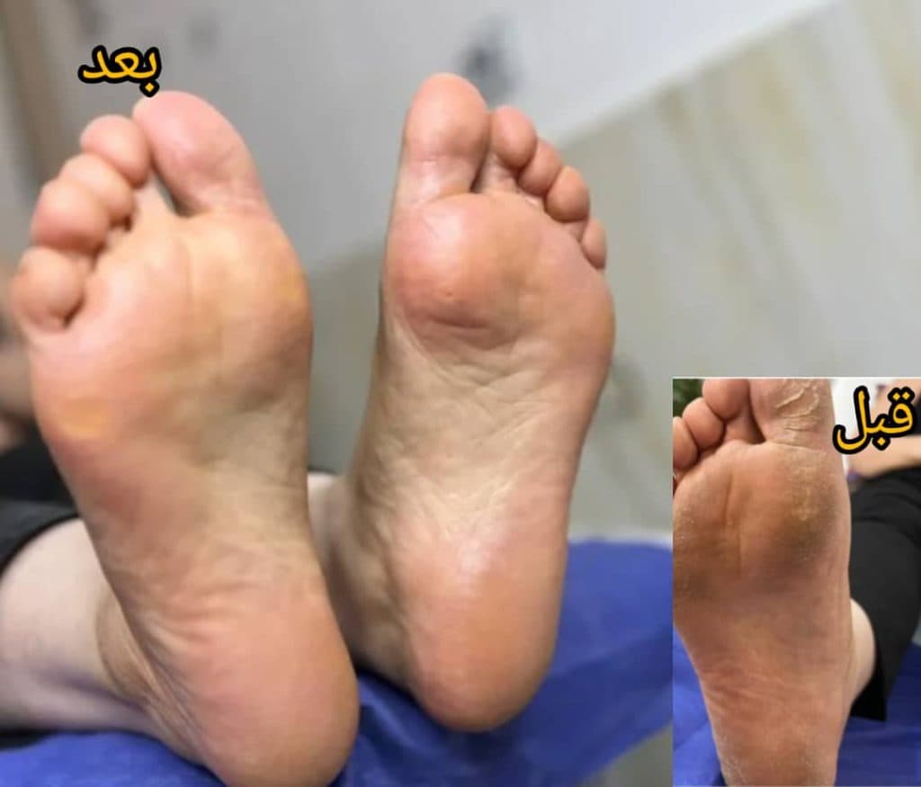 خدمات پدیکور درمانی مینا در رفسنجان