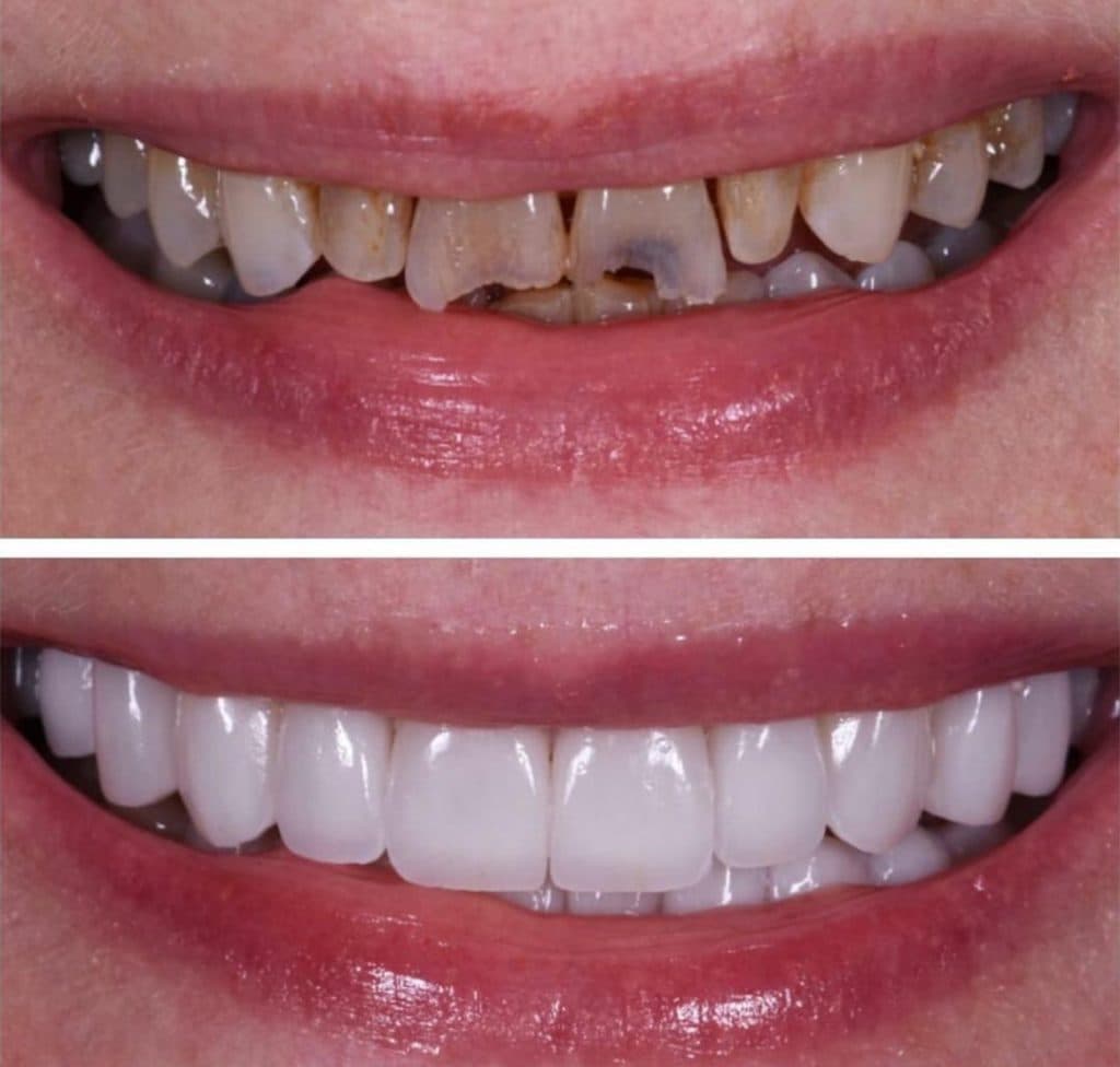 مطب دندانپزشکی نیما دنت در ونک تهران