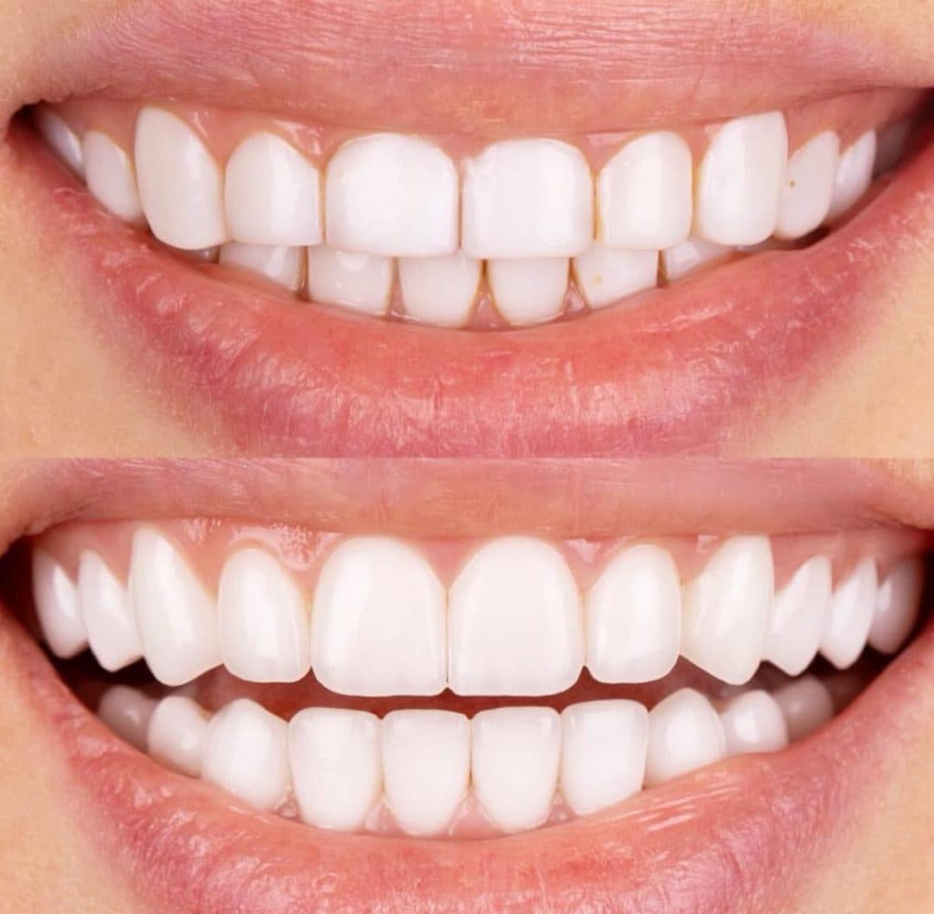 مطب دندانپزشکی نیما دنت در ونک تهران