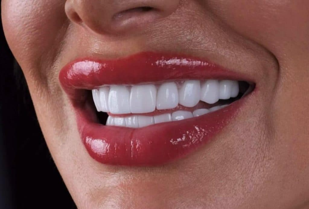 مطب دندانپزشکی نیما دنت در ونک تهران