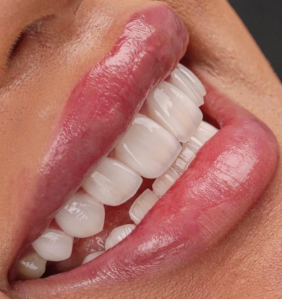 مطب دندانپزشکی نیما دنت در ونک تهران