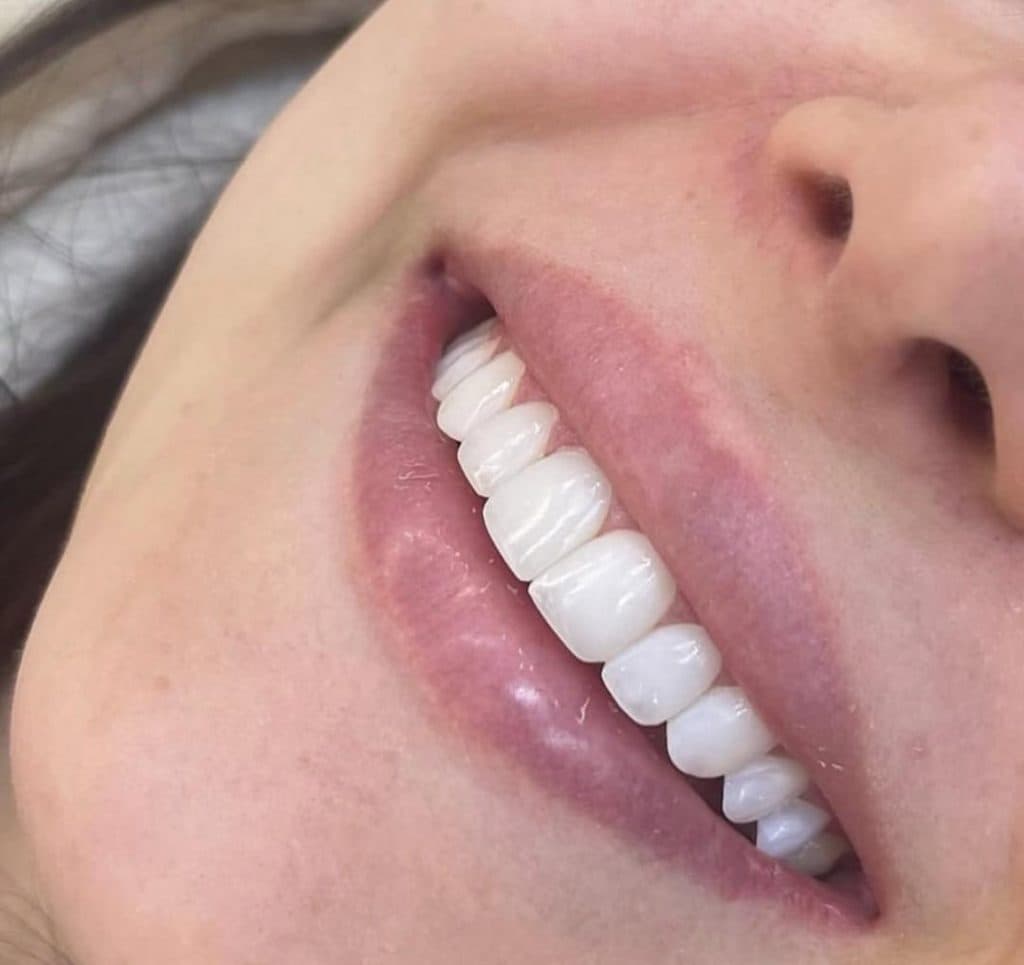 مطب دندانپزشکی نیما دنت در ونک تهران