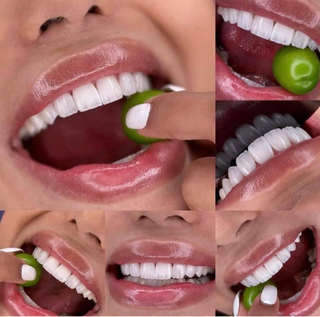 مطب دندانپزشکی نیما دنت در ونک تهران